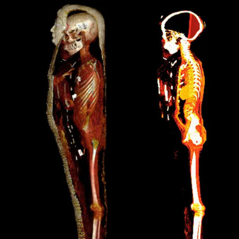 Η μούμια «Golden Boy» στην Αίγυπτο εξετάστηκε με τη βοήθεια αξονικού τομογράφου