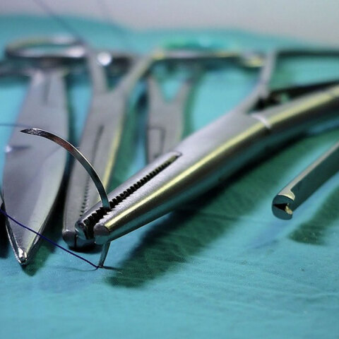 14χρονη στη Θεσσαλονίκη πέθανε μετά το χειρουργείο για την τοποθέτηση γαστρικού δακτυλίου