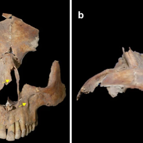 Βρέθηκε κρανίο με τετράγωνη τρύπα στο Ισραήλ