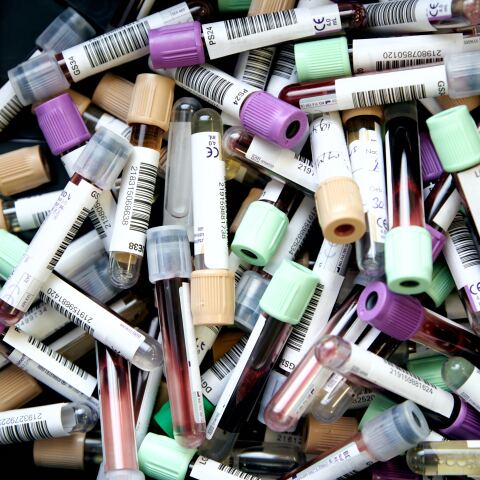 Δοχεία με αίμα