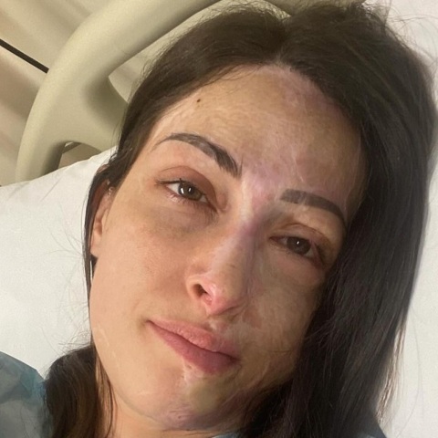 Ιωάννα Παλιοσπύρου: «Πλέον όλα έχουν ως σκοπό τη βελτίωση και όχι να μου σώσουν τη ζωή»