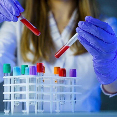 Συμφωνία συνεργασίας Ομίλου Chiesi με τη Haisco Pharmaceutical