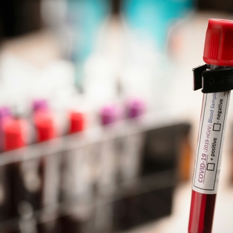 Μαγιορκίνης για κορονοϊό: Έως τέλος Ιανουαρίου η κορύφωση της έξαρσης της Covid-19 - Έχει υποτιμηθεί το ενισχυμένο εμβόλιο