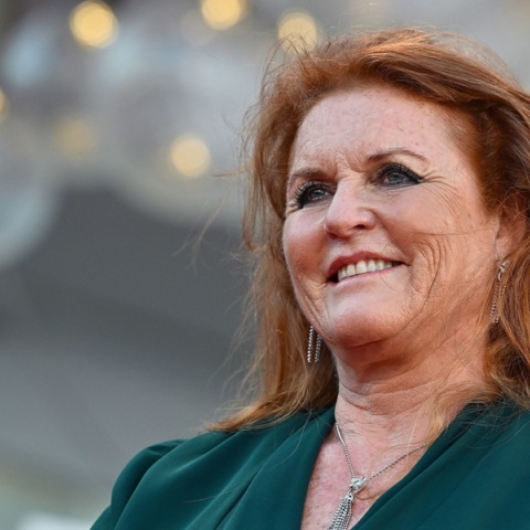 Η Σάρα Φέργκιουσουν, η Δούκισσα της Υόρκης, πάσχει από κακοήθες μελάνωμα