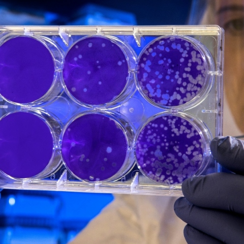 Επιστήμονες χρησιμοποίησαν κύτταρα από υγρό που αντλήθηκε κατά τη διάρκεια της εγκυμοσύνης για να αναπτύξουν μίνι πνεύμονες και άλλα όργανα