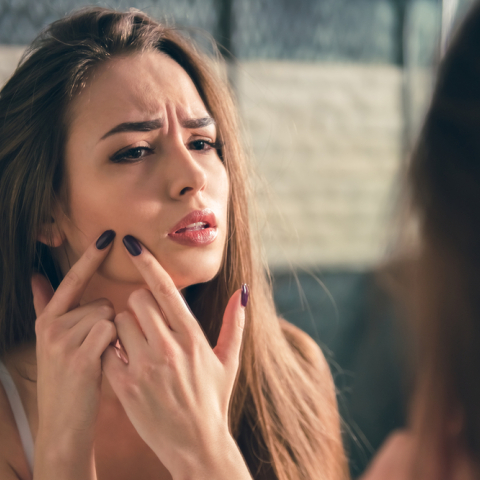 Πώς αποφεύγονται οι ουλές ακμής;