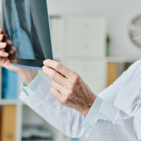 Γιατρός εξετάζει ακτινογραφία