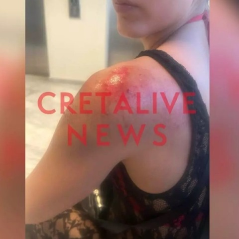 Κρήτη: Οδηγός φωτογράφισε κρυφά τα οπίσθια 25χρονης, την χτύπησε με το μηχανάκι και την έσυρε στο οδόστρωμα