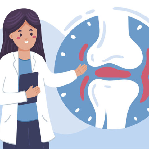 Οστεοαρθρίτιδα