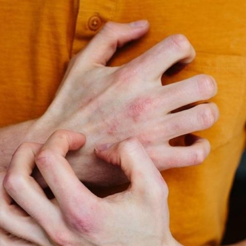 Κόκκινα σημάδια στο δέρμα: Η προειδοποίηση των γιατρών 