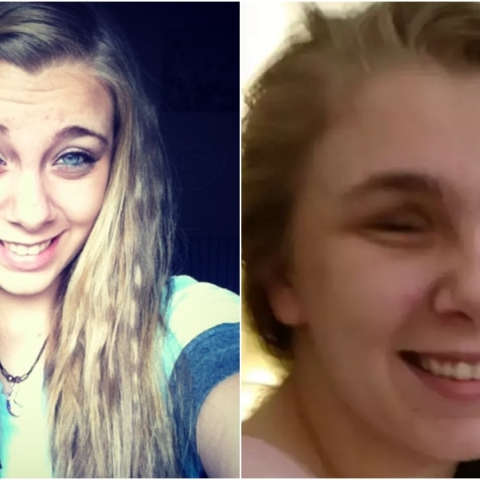 Kaylee Murther: Το κορίτσι που τύφλωσε τον εαυτό της εξηγεί το γιατί