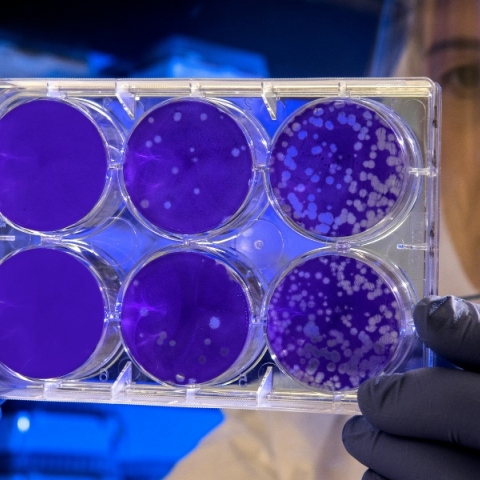 επιστημονας κραταει δοχεια με βακτηρια