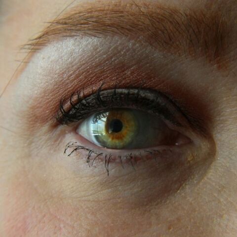 Φακοί επαφής: To συχνό λάθος που οδήγησε μια γυναίκα σε τύφλωση 