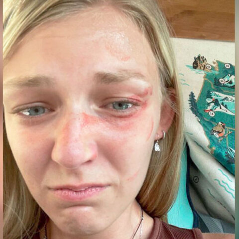 Η ιστορία της Γκάμπι Πετίτο που έγινε ντοκιμαντέρ στο Netflix