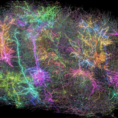 Εγκέφαλος: Ο πιο λεπτομερής χάρτης του μέχρι σήμερα - Έλληνας στην ερευνητική ομάδα