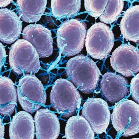 Γονόρροια: Nέο χάπι δίνει ελπίδες σε εκατομμύρια γυναίκες