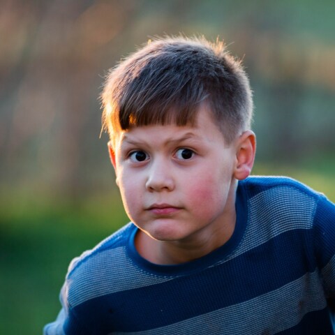 Γιατί το Πάσχα «φουντώνει» το... έκζεμα; 