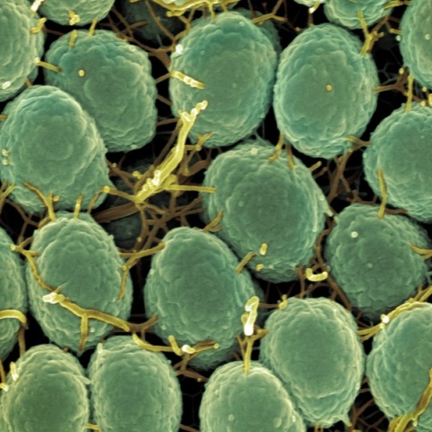 Το πρώτο εμβόλιο κατά της γονόρροιας ξεκινά πιλοτικά στην Αγγλία