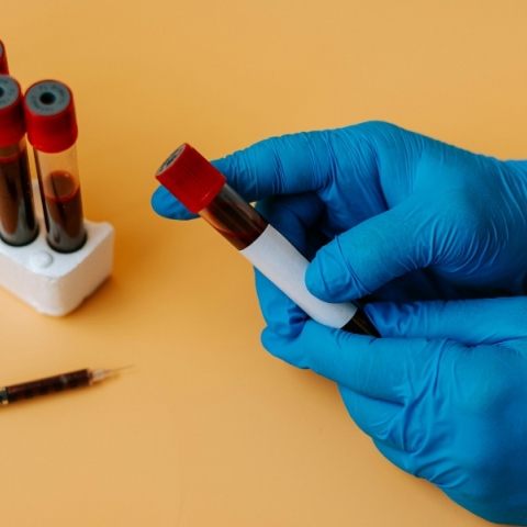 χερι, γαντια, φυαλιδια, αιμα