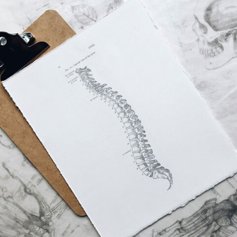 Αξονική Σπονδυλαρθρίτιδα