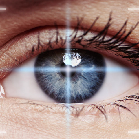 Μυωπία και αστιγματισμός: Πότε διορθώνονται με λέιζερ