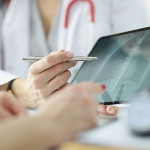 ακτινογραφια θωρακος