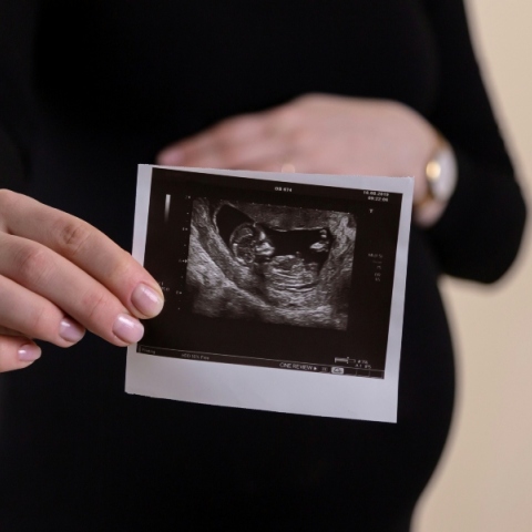 εγκυος, υπερηχογραφημα