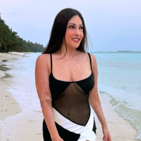 Η εξομολόγηση της Ιωάννας Παλιοσπύρου: Έμαθα να αγαπάω το σώμα μου ξανά γιατί με κράτησε ζωντανή