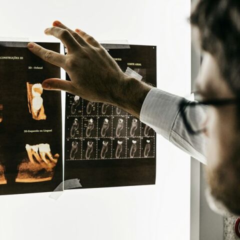 Πέντε ανεπαίσθητα συμπτώματα που οι οδοντίατροι λένε ότι δεν πρέπει ποτέ να αγνοήσετε