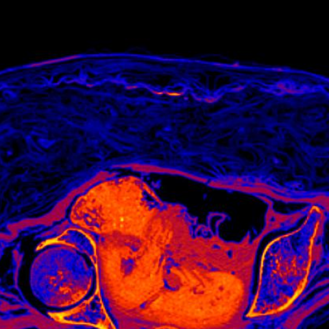 Επιστήμονες δημιούργησαν από βλαστοκύτταρα συνθετικό έμβρυο ποντικιού – Ορόσημο στην αναδημιουργία των πρώτων σταδίων της ζωής