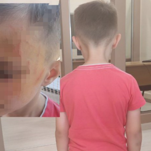 Αγρίνιο: Μητέρα καταγγέλλει τον ξυλοδαρμό του 5χρονου γιου της σε προαύλιο νηπιαγωγείου