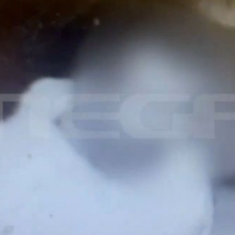 Την τραυμάτισε πάνω από 100 φορές - Σοκάρει η επίθεση 43χρονου στην έγκυο σύντροφό του με πιρούνι