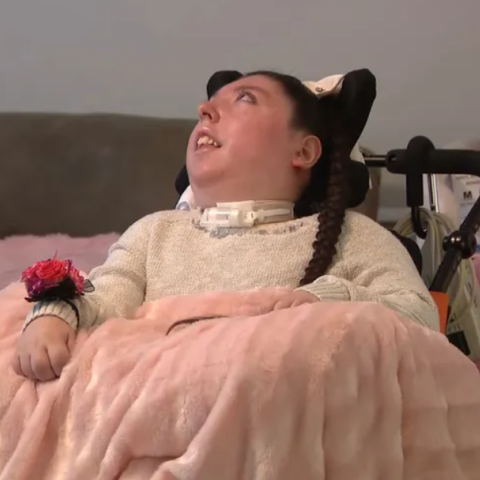 Γυναίκα που γεννήθηκε σχεδόν χωρίς εγκέφαλο έκλεισε τα 20 - Οι γιατροί της έδιναν 4 χρόνια ζωής