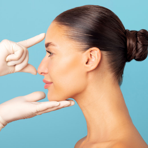 ρινοπλαστική