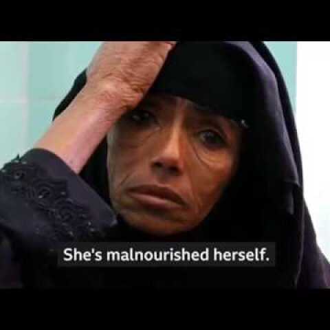 Yemen Could Be 'Worst Famine In 100 Years'