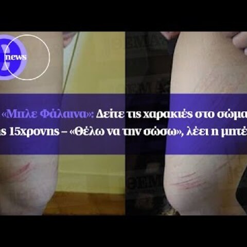 «Μπλε Φάλαινα»: Δείτε τις χαρακιές στο σώμα της 15χρονης – «Θέλω να την σώσω», λέει η μητέρα