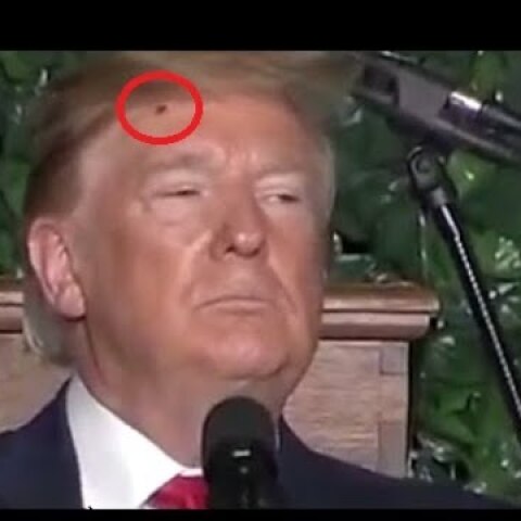 Bug Lands On President Trump's Forehead & Crawls Into His Hair While Giving Speech At Jamestown