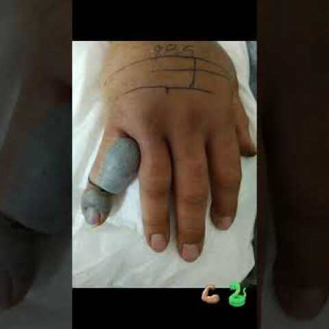 ΓΟΝΝΟΙ ΛΑΡΙΣΑΣ ΔΑΓΚΩΜΑ-ΤΣΙΜΠΗΜΑ, ΔΗΛΗΤΗΡΙΟ ΦΙΔΙΟΥ (ΟΧΙΑΣ) 5/5/2020 (ψηλός), GONNOI, SNAKE