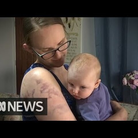 Mum risked her life to protect baby from giant hail | ABC News