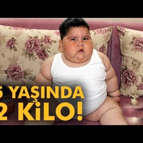 1,5 Yaşında 32 Kilo
