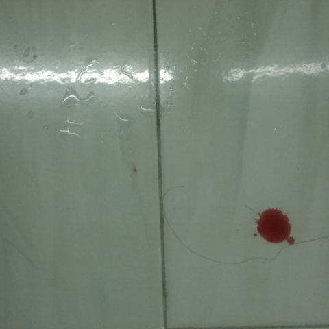 Χανιά, αυτοπυροβολήθηκε