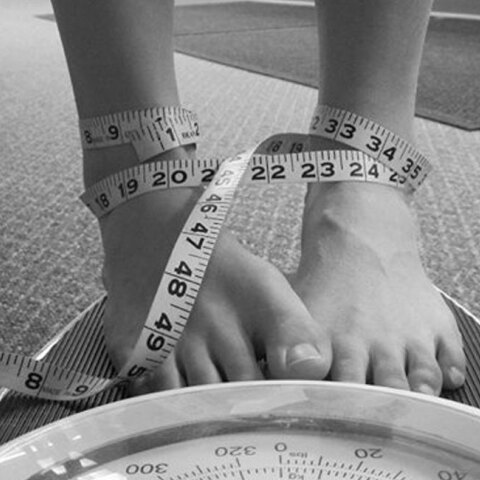 Νευρική ανορεξία