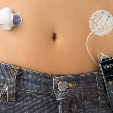 artificial-pancreas-medtronic-fda-medtech.jpg