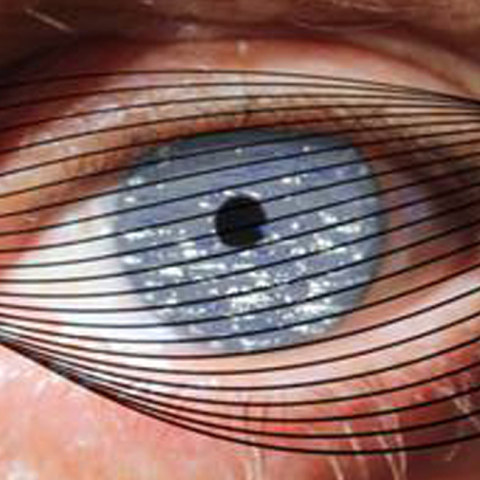 Φεστιβάλ LIF, Σίκινος