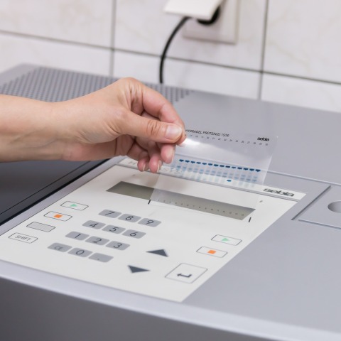 Ελπιδοφόρα μηνύματα για την κυστική ίνωση 