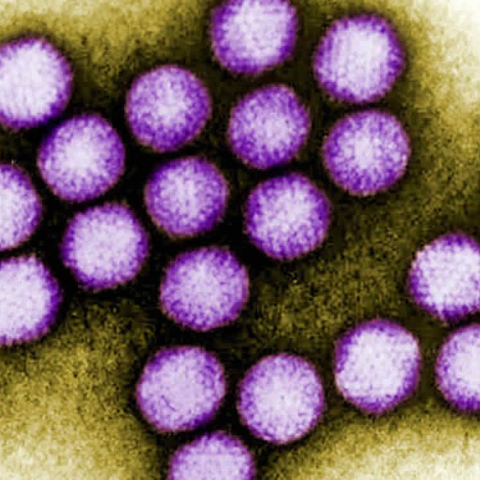adenovirus-infection.jpg