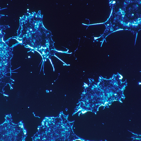 cancer-cells-541954_1920.jpg