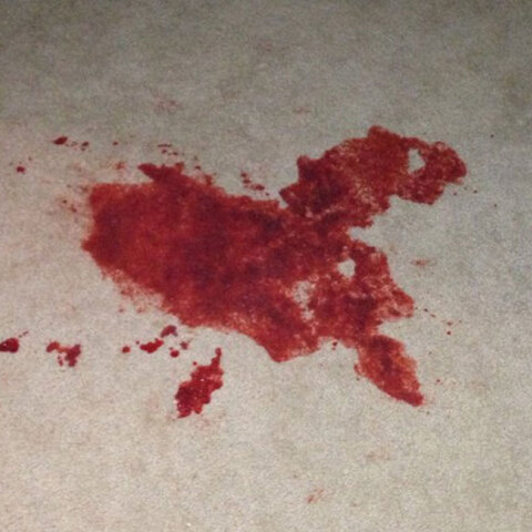 Απόπειρα αυτοκτονίας