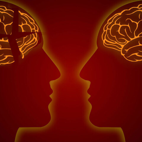 Nόσος Αλτσχάιμερ