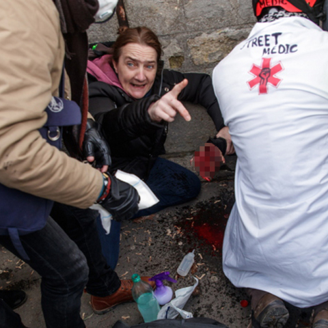 Χειροβομβίδα σκάει στο χέρι διαδηλωτή των Κίτρινων Γιλέκων